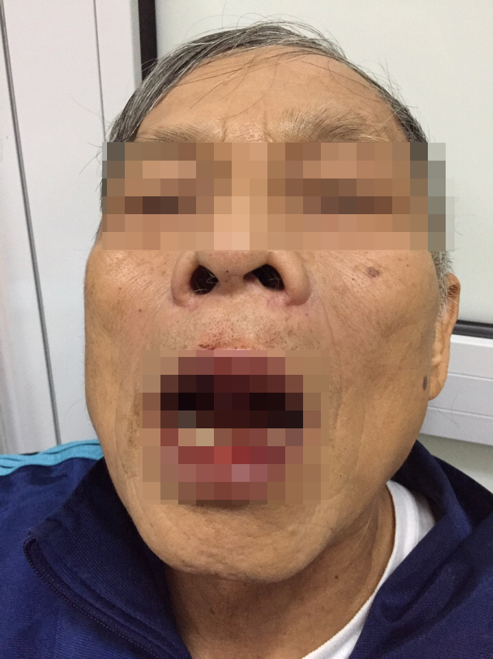 Tiến sĩ già 76 tuổi bị đấm túi bụi khi chưa rõ nguyên nhân