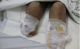 Lý do khiến nhân viên y tế ở Cần Thơ tự cắt chân rồi giấu trong tủ