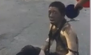 Nổ bốt điện ở Hà Đông: Người đàn ông tật nguyền bỏng tuột da gào thét thảm thương