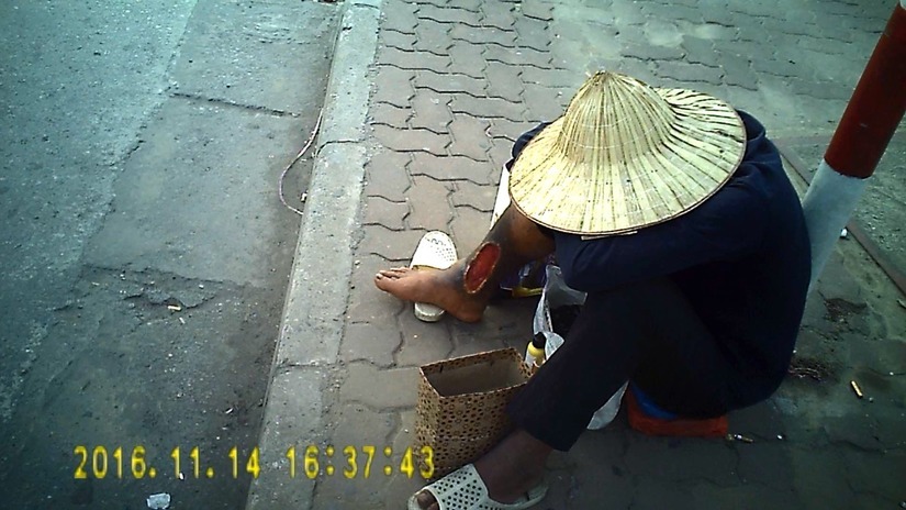 Gã ăn xin với chiếc chân bị hoại tử xuất hiện ở ngã tư Giải Phóng - Đại Cồ Việt