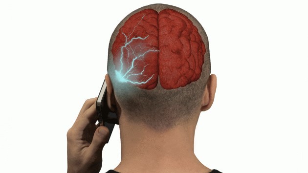 iphone 7 bị rò sóng gây teo não