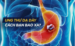 Thói quen bị ung thư dạ dày nhiều người Việt đang mắc phải