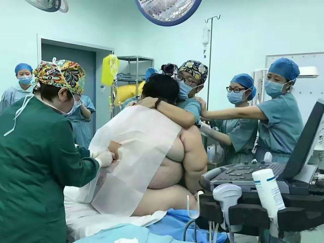 16 bác sĩ, ý tá hợp sức đỡ đẻ cho bà mẹ nặng hơn 1 tạ