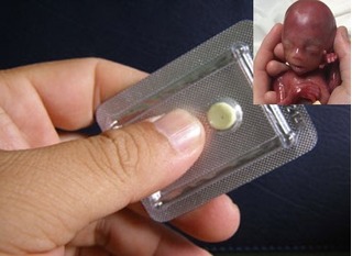 Các cô gái hãy đọc ngay, đây là hậu quả việc lạm dụng thuốc tránh thai khẩn cấp