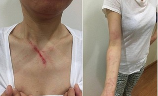 Chung cư Linh Đàm: Nhắc nhở giữ vệ sinh, một phụ nữ bị đánh bầm dập trong thang máy