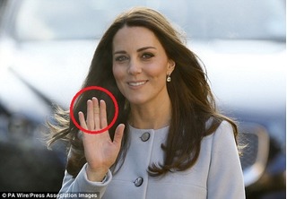 Những miếng băng dán kì lạ trên tay công nương Kate Middleton