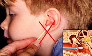 Mách mẹ cách lấy ráy tai an toàn, không đau cho bé ngay tại nhà