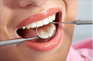 Phòng chống sâu răng và cách phát hiện ra bệnh