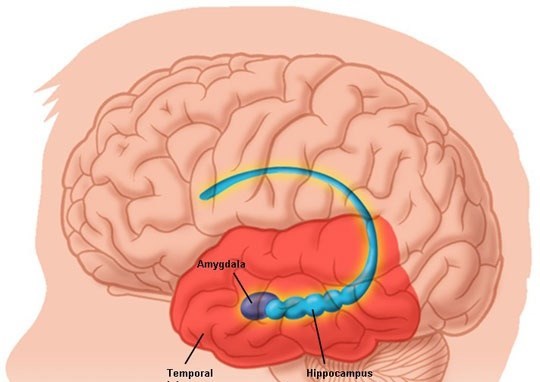 Viêm màng não mô cầu do vi khuẩn gây bệnh viêm màng não là Neisseria Meningitidis gây ra.
