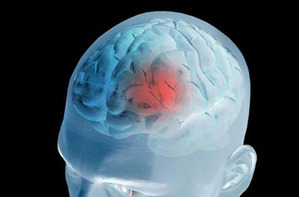 Đặc điểm động mạch não và bệnh huyết quản não có gì liên quan?