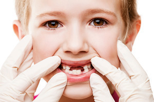 Bố mẹ hãy làm ngay những việc sau đây để ngăn ngừa sâu răng ở trẻ!