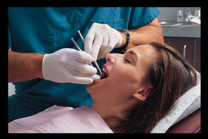 Nhổ răng khôn có thể gây ra những biến chứng nào?
