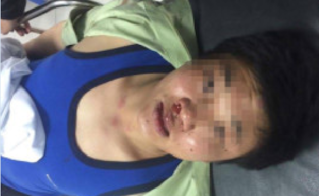 Công an đang điều tra vụ người đàn ông bị hành hung dã man khi nhậu tại nhà một Giám đốc ở Hà Nội