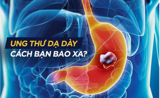 Thói quen bị ung thư dạ dày rất nhiều người Việt đang mắc phải