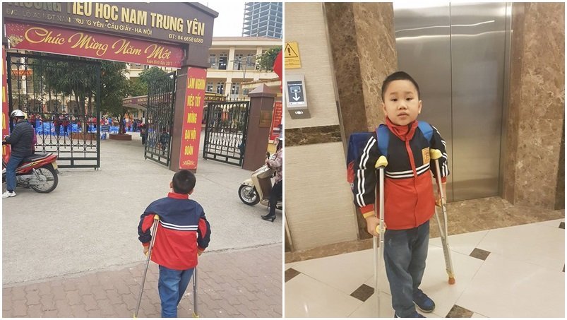 Cháu Trần Chí Kiên trong ngày đầu tiên trở lại trường sau 3 tháng phải nghỉ học vì tai nạn
