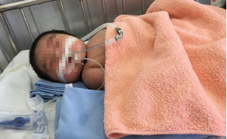Lai Châu: Trẻ 4 tháng tuổi tím tái rồi tử vong sau khi tiêm vắc xin BCG