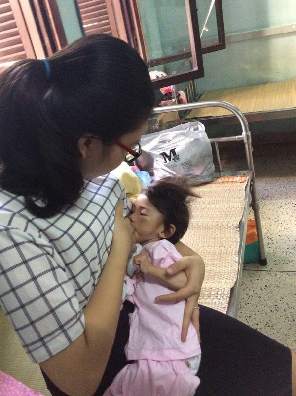bé gái Lào Cai bị suy dinh dưỡng 11