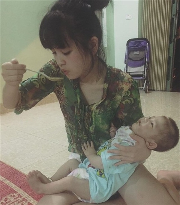 bé gái Lào Cai bị suy dinh dưỡng 19