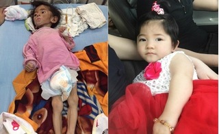 Bé gái Lào Cai 14 tháng tuổi nặng 3,5kg thay đổi thần kỳ nhờ mẹ nuôi 9X