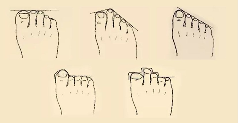 Đoán vận mệnh sướng khổ qua độ dài ngắn của ngón chân 1