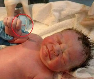 Sự thật bất ngờ về bức ảnh bé sơ sinh nắm chặt vòng tránh thai gây bão mạng