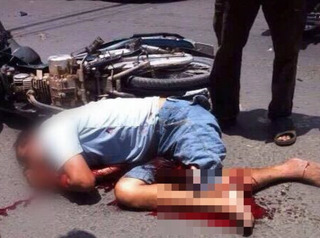 Va chạm với xe ba gác, một người đi xe máy bị đâm nát chân