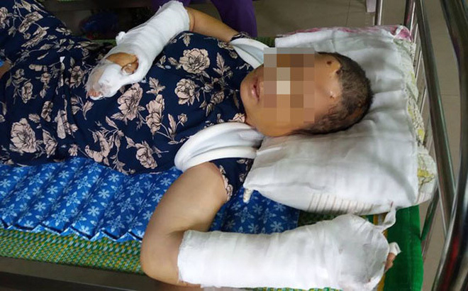 Bà Nguyệt đang được điều trị tai bệnh viện sau khi bị chồng hành hung
