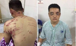 Côn đồ hành hung dã man lúc nửa đêm, 4 người ở Hà Nội nhập viện