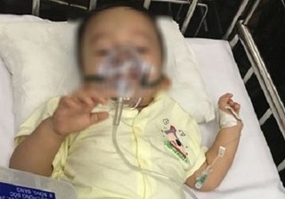 Hai người bà tiết lộ thông tin bất ngờ, bé trai hơn 1 tuổi chuyển biến xấu vì xuất huyết não