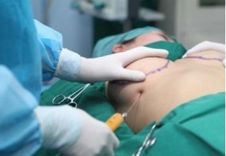 Thai phụ 22 tuổi tử vong sau nâng ngực: Yêu cầu bác sĩ ngừng hoạt động ngoài chuyên môn