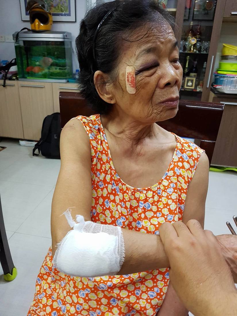 Bà cụ 80 tuổi bị đâm ở Thanh Xuân 5
