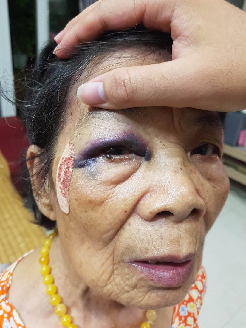 Bà cụ 80 tuổi bị đâm ở Thanh Xuân tài xế bỏ trốn1