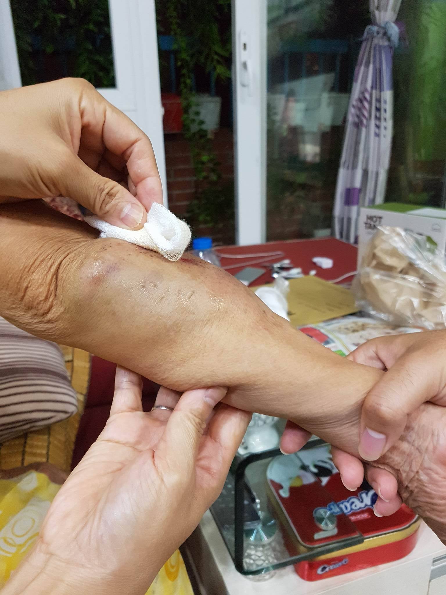 Bà cụ 80 tuổi bị đâm ở Thanh Xuân tài xế bỏ trốn 2