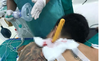 Nam thanh niên bị bạn gái dùng dao đâm vào lưng sau tiệc rượu