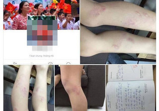 Chủ tịch UBND Hà Nội yêu cầu làm rõ vụ 11 học sinh bị giáo viên bạo hành