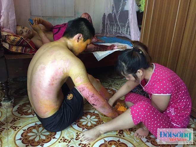 Do kinh phí hạn hẹp nên khi qua cơn nguy kịch gia đình bà Thuận đã xin cho các cháu và con rể về nhà điều trị