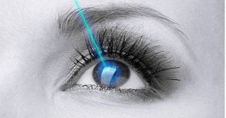 Giải mã phương pháp mới mổ mắt cận thị không chạm vào mắt