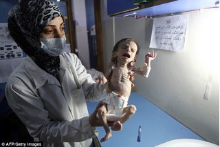 Bức hình em bé Syria gầy trơ xương, nặng 2kg vì đói khiến cả thế giới rúng động
