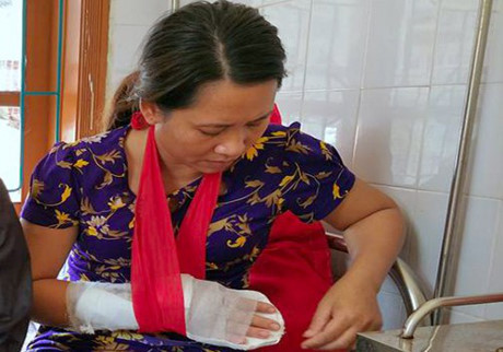 Chém phó trạm trưởng trạm y tế Hà Tĩnh: Khởi tố bị can