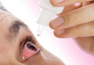 Những loại thuốc trị đau mắt đỏ hiệu quả nhất