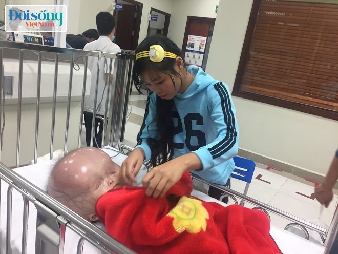 Bé trai mắc bệnh đầu nặng 15kg ở Thanh Hóa, người mẹ lên tiếng tiết lộ lý do không đưa con sang Singapore
