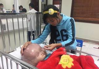 Mẹ cháu bé bị não úng thủy ở Thanh Hóa tiết lộ lý do thực sự không đưa con sang Singapore chữa bệnh