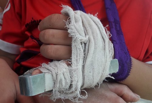 Cô giáo đánh học sinh gãy ngón tay ở Nghệ An kêu oan