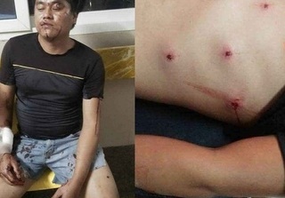 Ninh Bình: Bị phát hiện và đuổi bắt, trộm chó liên tiếp nổ súng hoa cải vào người dân 