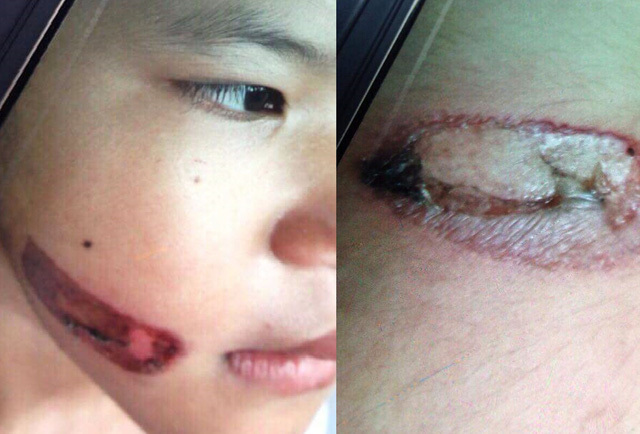 Bé gái 7 tuổi nghi bị bạo hành ở Kiên Giang, cha mẹ kế lên tiếng phụ nhận sự việc