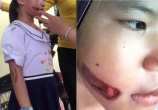 Cha và mẹ kế bé gái 7 tuổi nghi bị bạo hành ở Kiên Giang: 