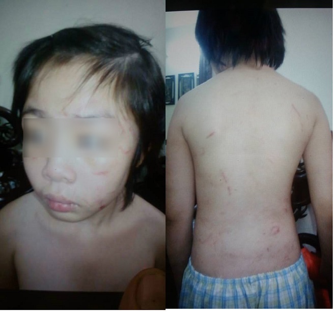 Chiều 5/12 bé trai bị bố ruột và mẹ kế bạo hành ở Hà Nội đã trốn từ nhà trọ về nhà ông bà nội ở Hoàng Hoa Thám để cầu cứu 