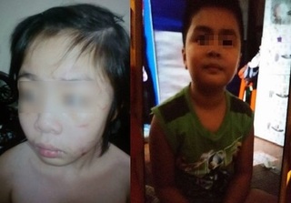 Bé trai 10 tuổi bị bố ruột và mẹ kế bạo hành ở Hà Nội, 3 lần mới thoát thân khỏi 