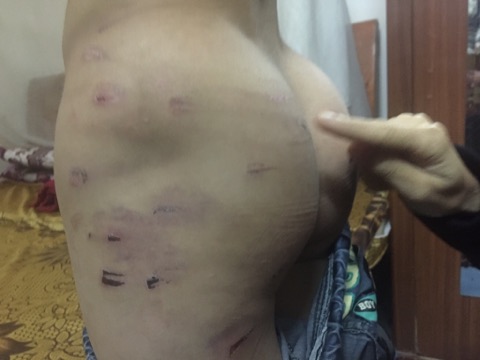  Hà Nội: Bé trai 9 tuổi bị bố ruột dùng dây điện đánh tím người