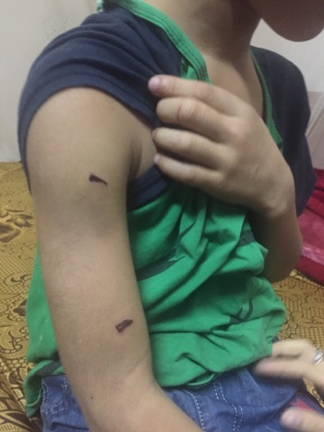  Hà Nội: Bé trai 9 tuổi bị bố ruột dùng dây điện đánh tím người